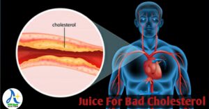 High Cholesterol :বাড়তে থাকা কোলেস্টেরল থেকে জীবন বাঁচাতে খেতে হবে এই তিন ধরনের জুস। 2 see right now